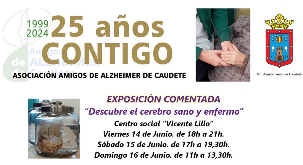 25 alzheimer caudete digital