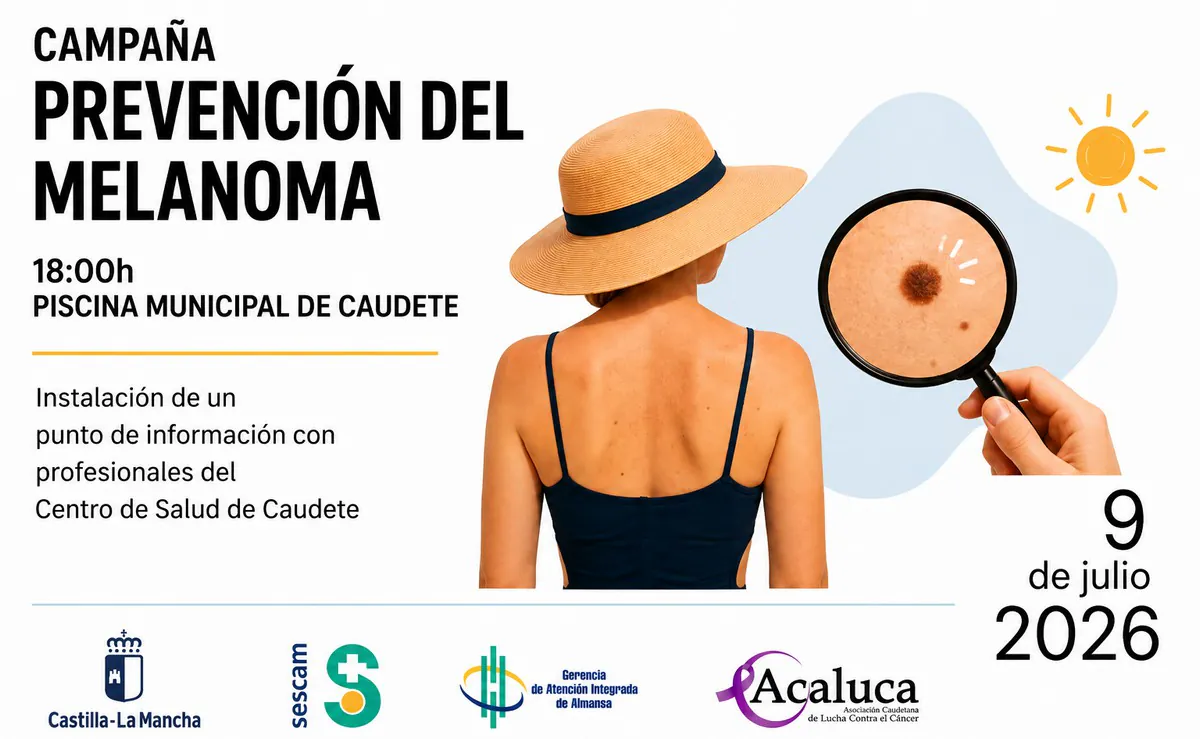melanoma caudete digital
